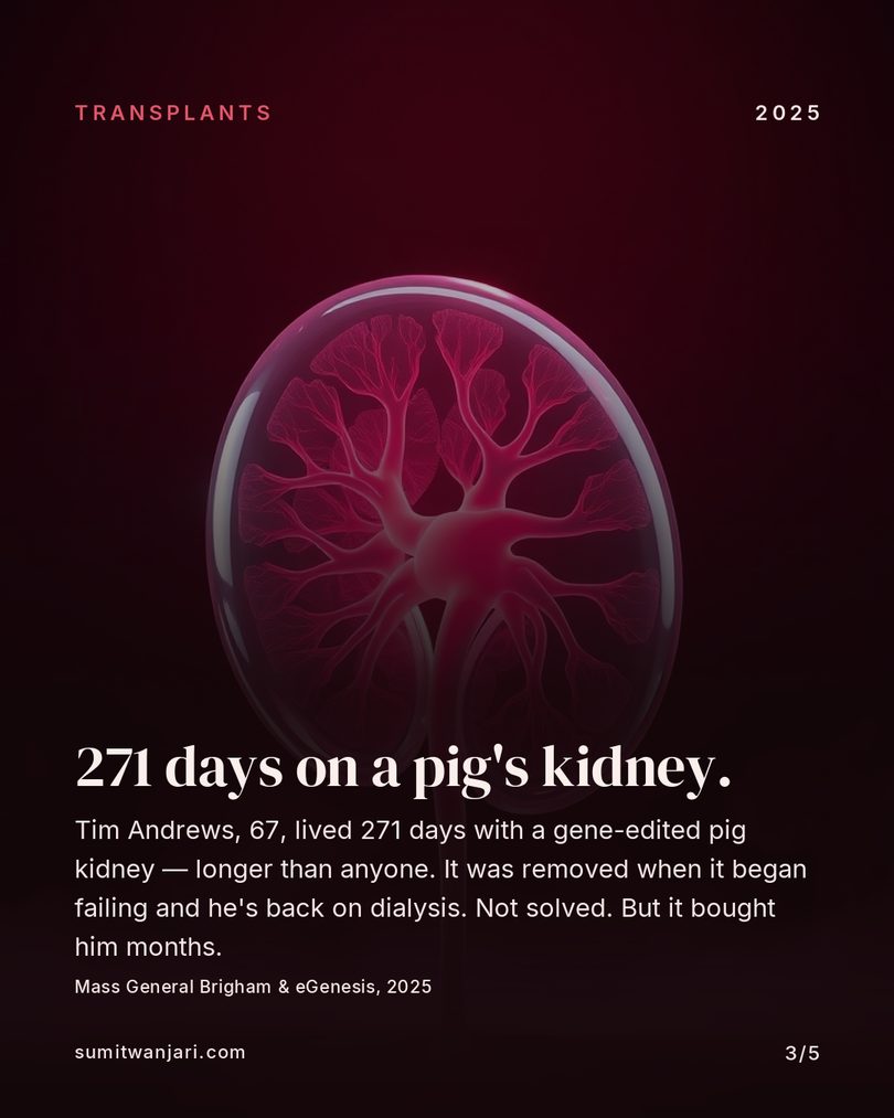 271 days on a pig's kidney — the longest xenotransplant survival, 2025