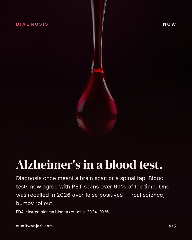 Alzheimer's in a blood test — plasma biomarkers now match PET scans over 90% of the time